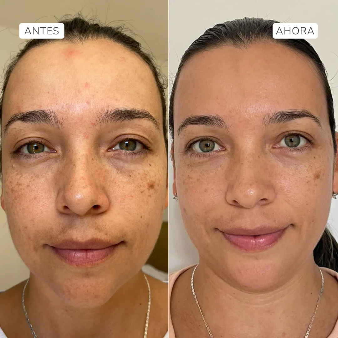 Suero facial Fito Retinol - Aruná - Image 4